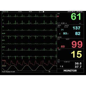 Monitor theo dõi bệnh nhân 3